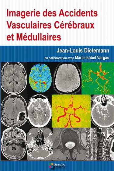 Couverture de Imagerie des accidents vasculaires cérébraux et médullaires