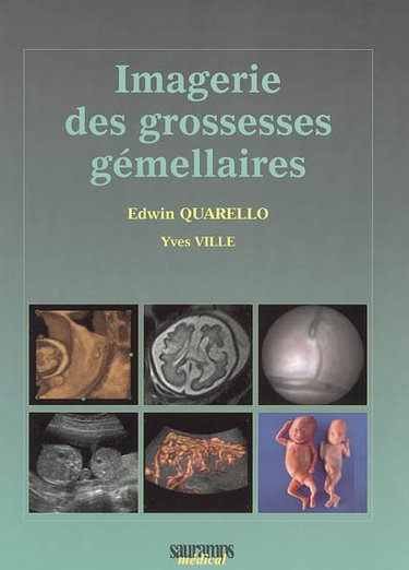 Couverture de Imagerie des grossesses gémellaires