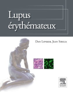 Couverture de Lupus érythémateux