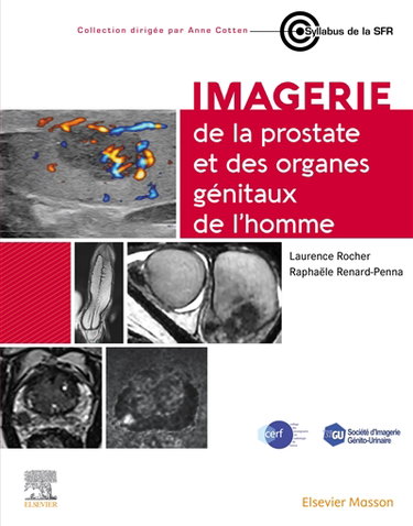 Couverture de Imagerie de la prostate et des organes génitaux de l'homme