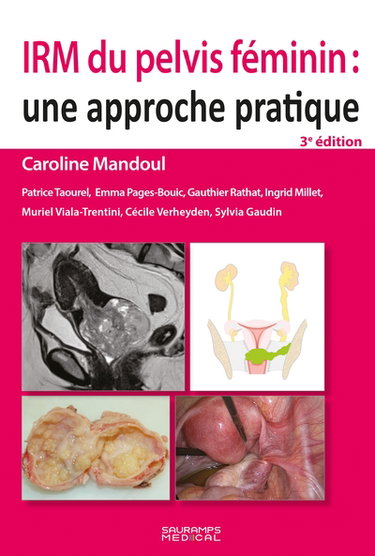 Couverture de IRM du pelvis féminin : une approche pratique