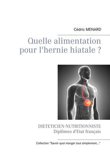 Couverture de Quelle alimentation pour l'hernie hiatale ?