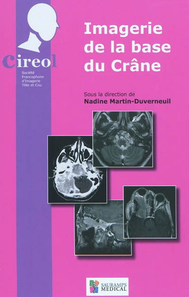 Imagerie de la base du crâne