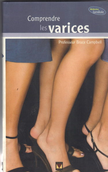 Comprendre les varices