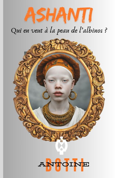 Couverture de ASHANTI: Qui en veut à la peau de l’abinos ?