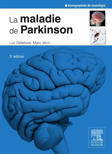 La maladie de Parkinson