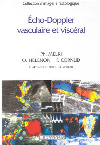 Écho-Doppler vasculaire et viscéral