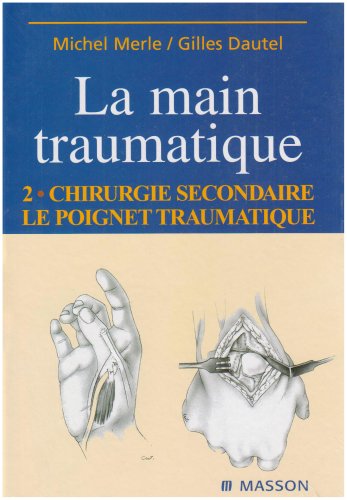 La main traumatique. Vol. 2. Chirurgie secondaire, le poignet traumatique