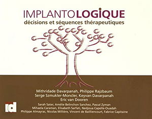 Implantologique: Décisions et séquences thérapeutiques