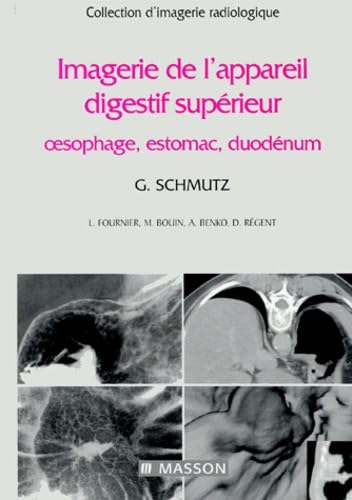 Imagerie de l'appareil digestif supérieur : oesophage, estomac, duodénum