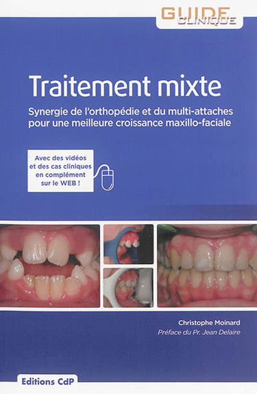 Traitement mixte : synergie de l'orthopédie et du multi-attaches pour une meilleure croissance maxillo-faciale
