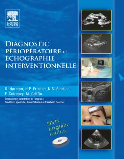 Diagnostic périopératoire et échographie interventionnelle