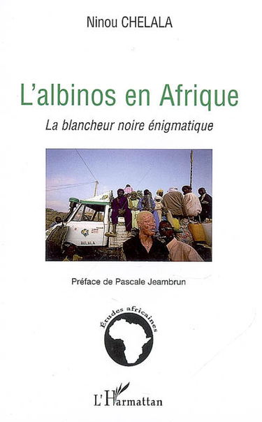 L'albinos en Afrique : la blancheur noire énigmatique