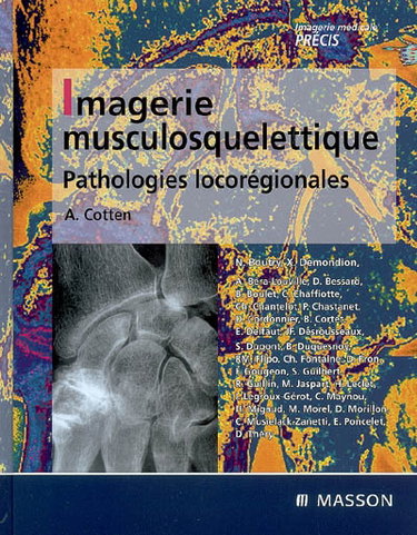 Couverture de Imagerie musculosquelettique : pathologies locorégionales