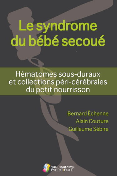 Le syndrome du bébé secoué : hématomes sous-duraux et collections péri-cérébrales du petit nourrisson