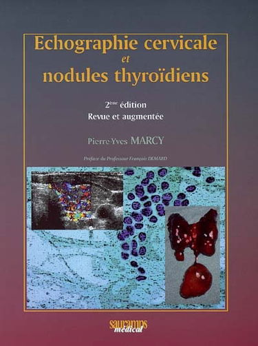 Echographie cervicale et nodules thyroïdiens