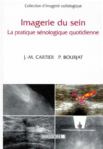 Imagerie du sein : la pratique gynécologique quotidienne