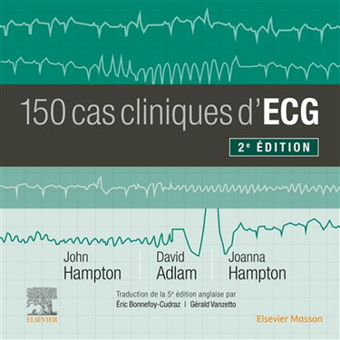 Couverture de 150 cas cliniques d'ECG par John R. Hampton