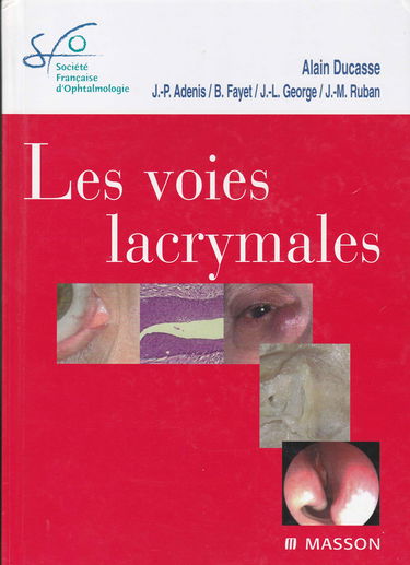 Les voies lacrymales
