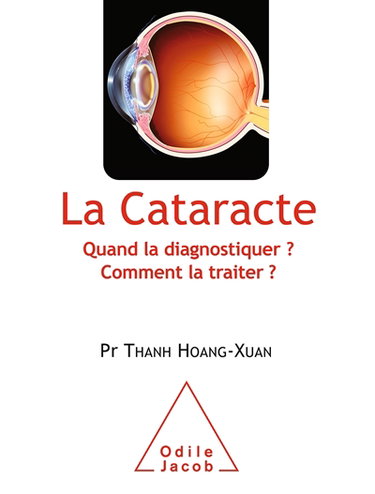 Couverture de La cataracte : quand la diagnostiquer ? comment la traiter ?