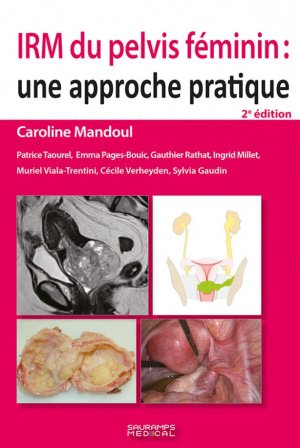 IRM du pelvis féminin : une approche pratique