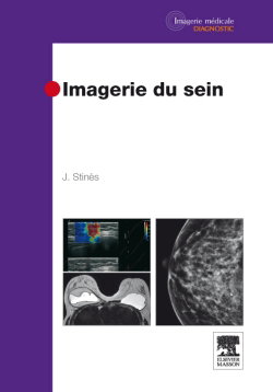 Couverture de Imagerie du sein