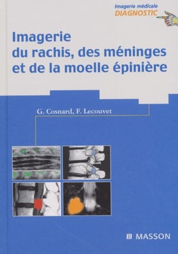 Imagerie du rachis, des méninges et de la moelle épinière