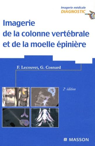 Imagerie de la colonne vertébrale et de la moelle épinière