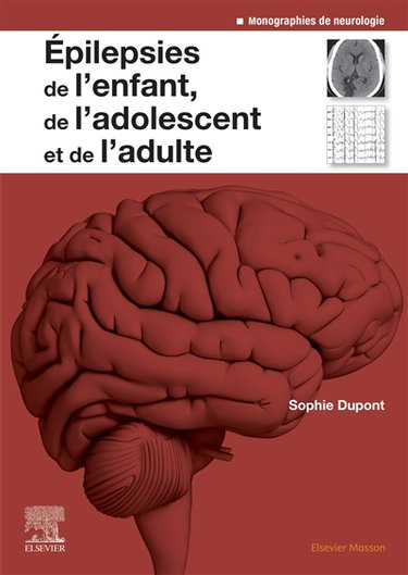 Couverture de Epilepsies de l'enfant, de l'adolescent et de l'adulte : de la physiopathologie à la prise en charge