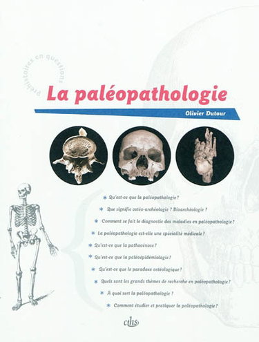 Couverture de La paléopathologie