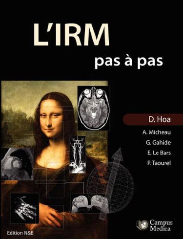 L'IRM pas à pas