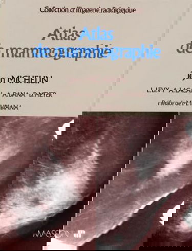 Atlas de mammographie