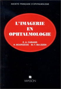 L'imagerie en ophtalmologie