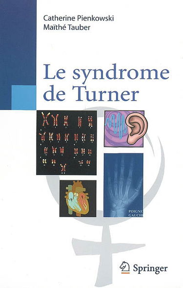 Le syndrome de Turner