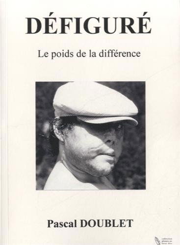 Défiguré : le poids de la différence