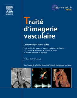 Couverture de Traité d'imagerie vasculaire