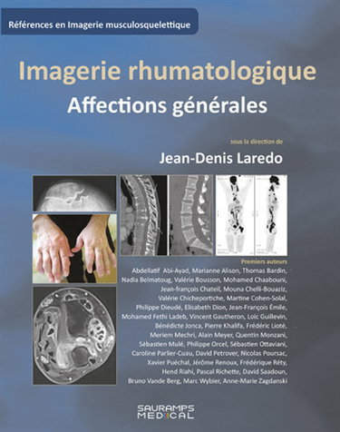 Couverture de Imagerie rhumatologique : affections générales