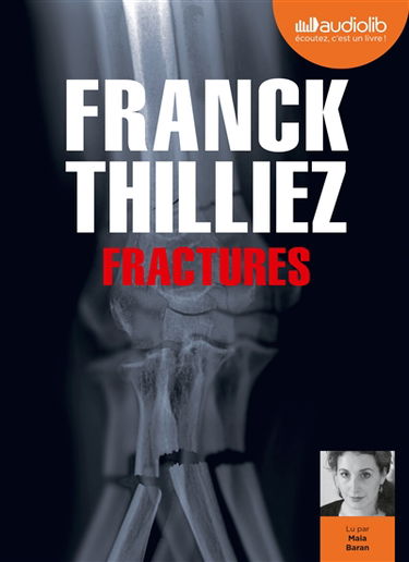 Fractures