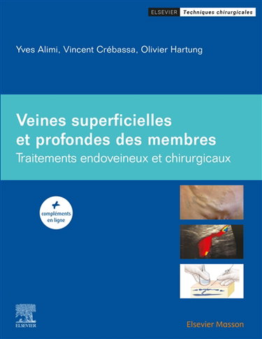Couverture de Veines superficielles et profondes des membres : traitements endoveineux et chirurgicaux