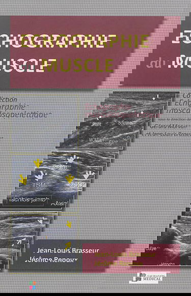 Echographie du muscle