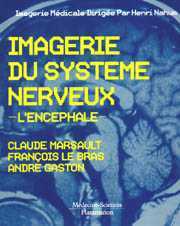 Imagerie du système nerveux : l'encéphale