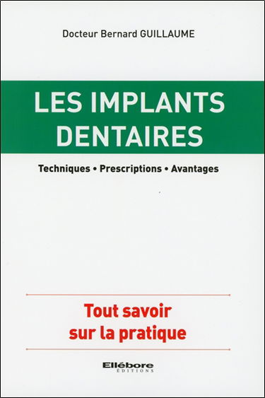 Les implants dentaires : techniques, prescriptions, avantages : tout savoir sur la pratique