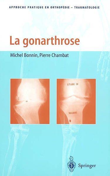 La gonarthrose