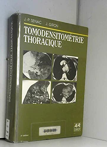 Tomodensitométrie thoracique