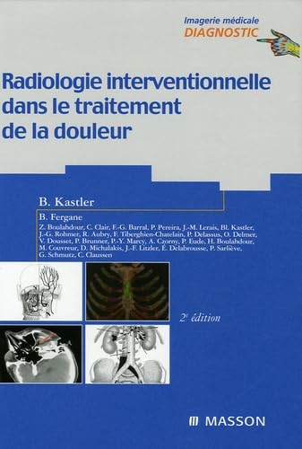 Radiologie interventionnelle dans le traitement de la douleur