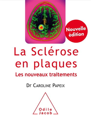La sclérose en plaques : les nouveaux traitements