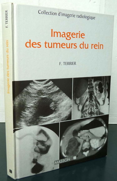 Imagerie des tumeurs du rein