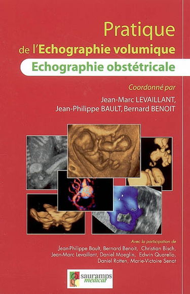 Echographie obstétricale