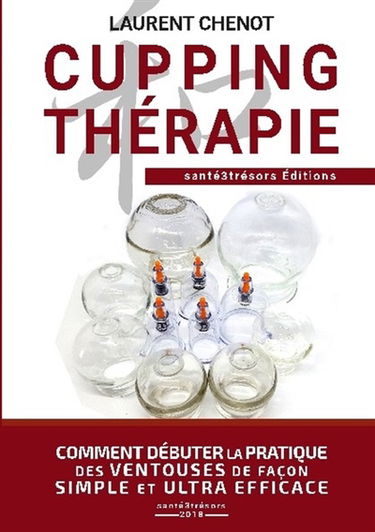 CUPPING THERAPIE : Comment débuter la pratique des ventouses de façon simple et ultra efficace.