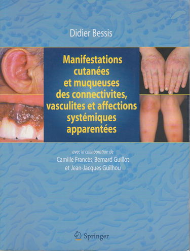 Manifestations cutanées et muqueuses des connectivites, vasculites et affections systémiques apparentées : Dermatologie et médecine, vol 1